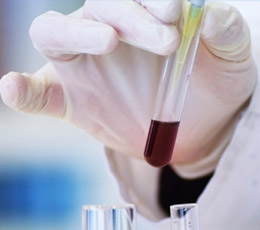 醫(yī)藥中間體